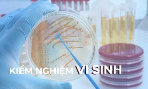 kiểm nghiệm vi sinh